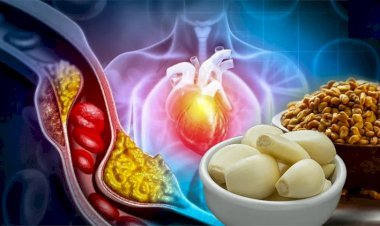 কোলেস্টেরল বাড়ার লক্ষণ