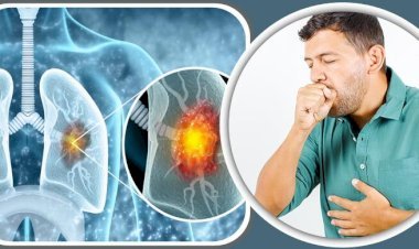 ধূমপান না করলেও কেন হয় ফুসফুসে ক্যানসার?