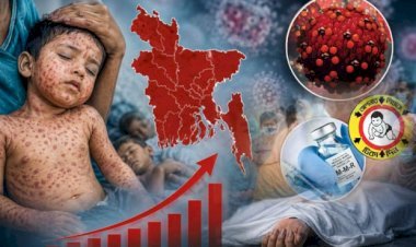সিলেটে হামের উপসর্গে আরও এক শিশুর মৃত্যু
